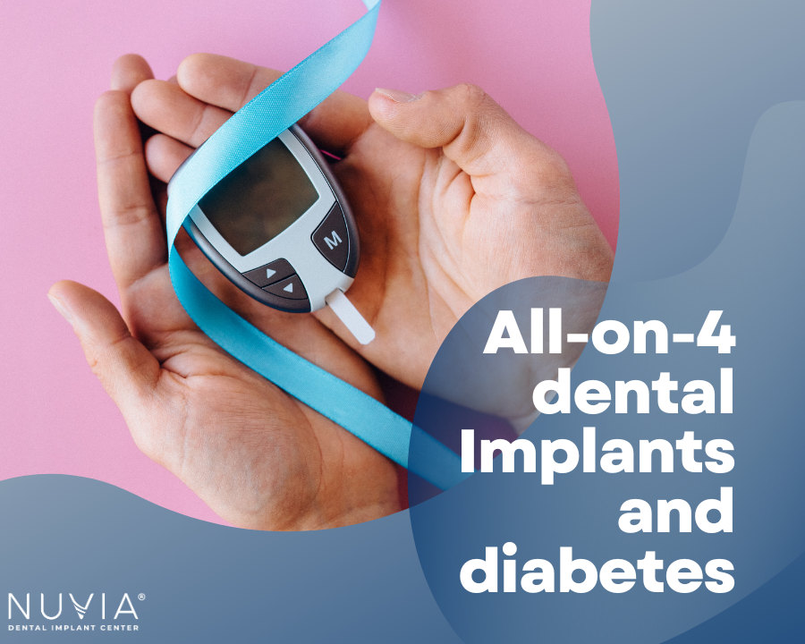 All on 4 Dental Implants and Diabetes What You Need to Know